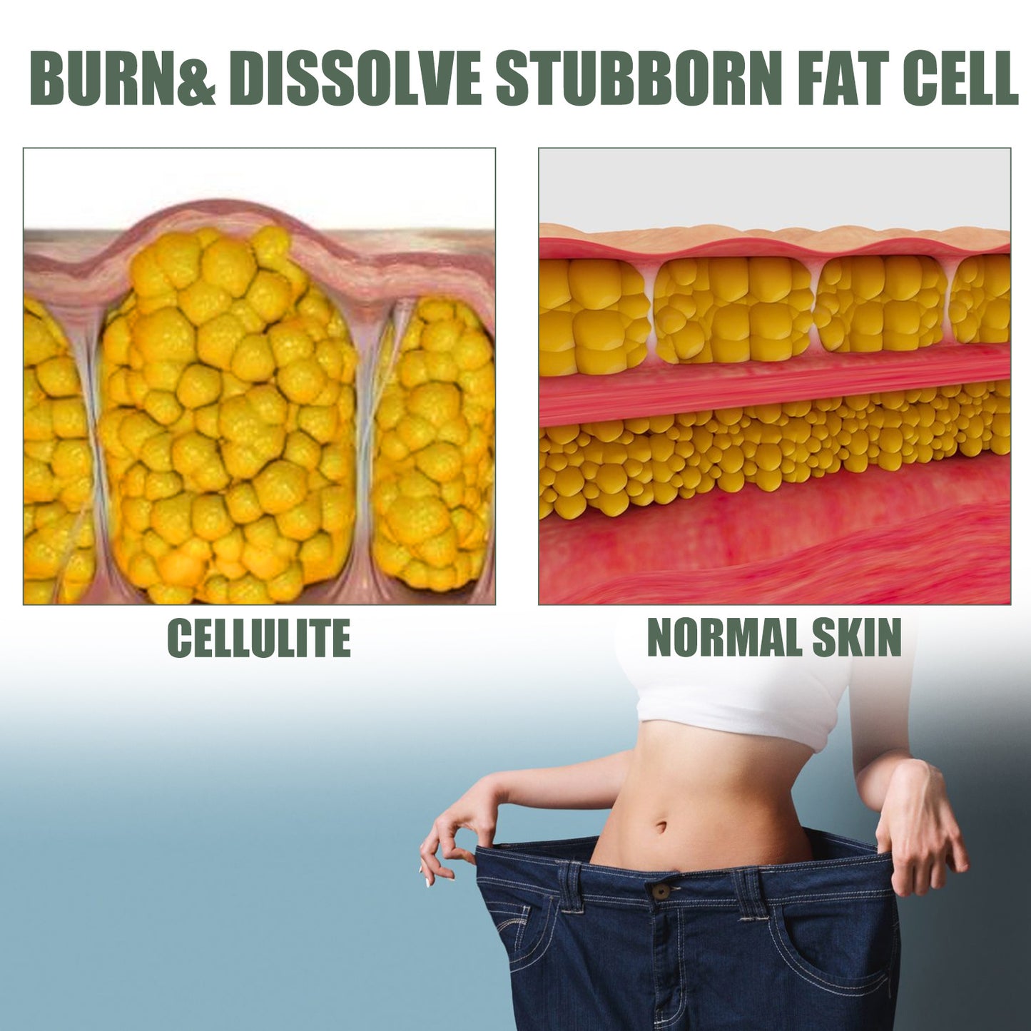 Fat Burning Cream