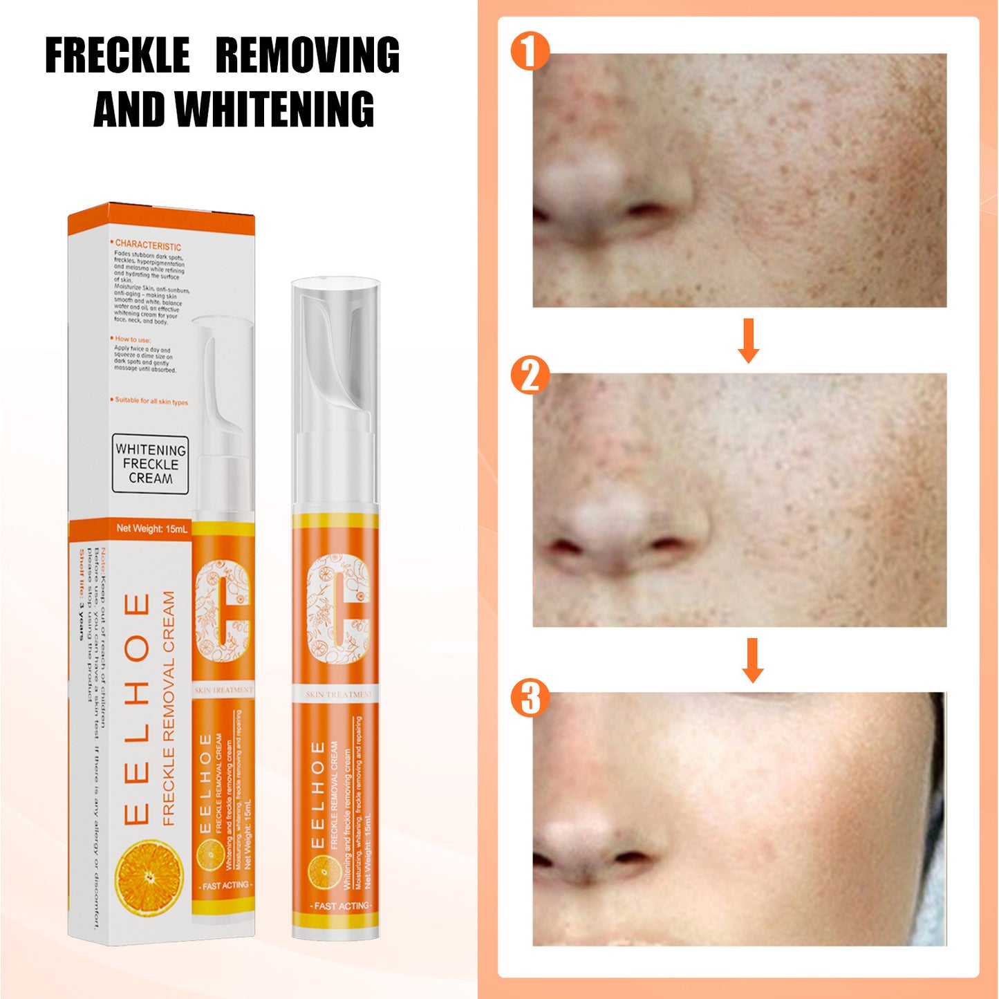 EELHOE Freckle Removal Cream