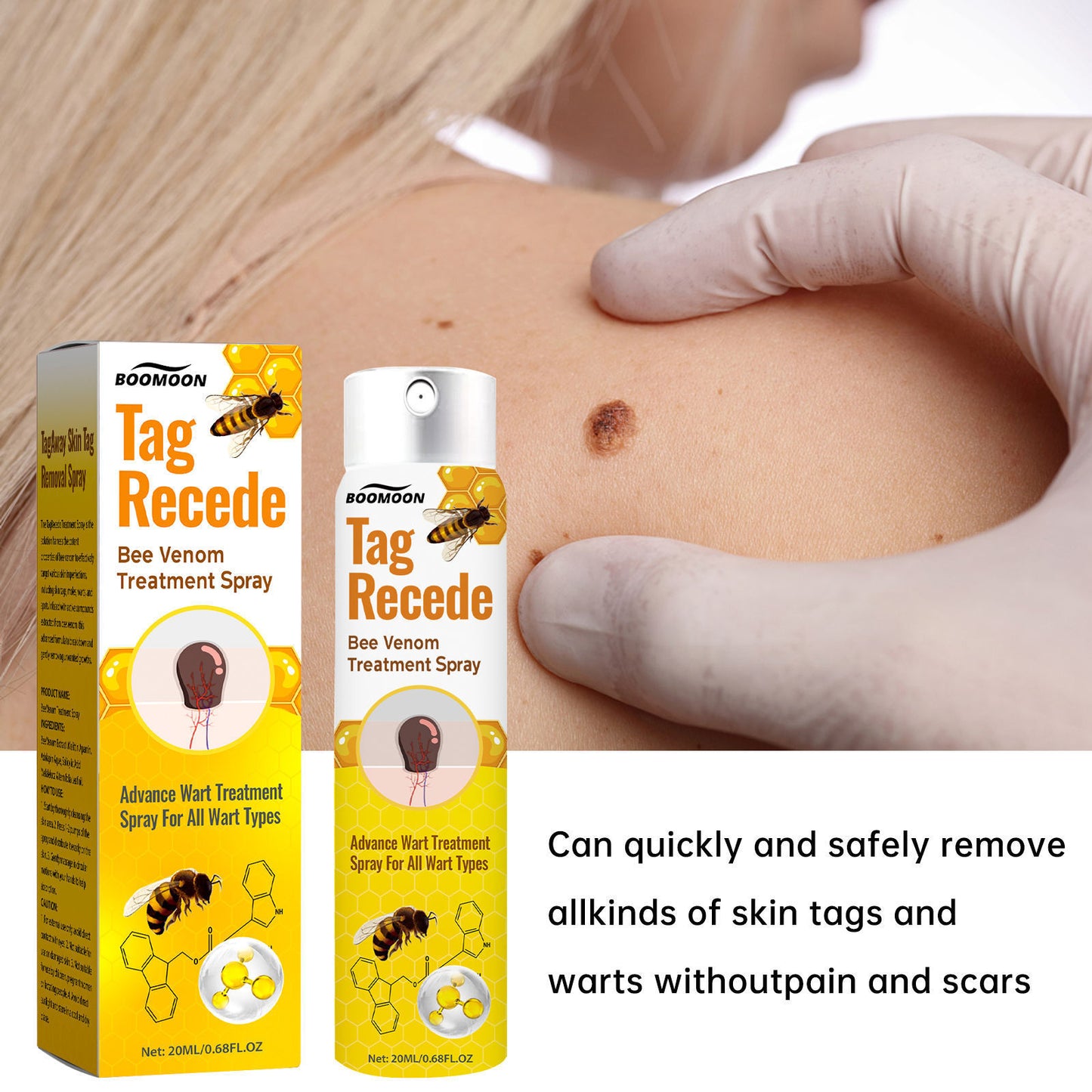 Wart Treatment Spray