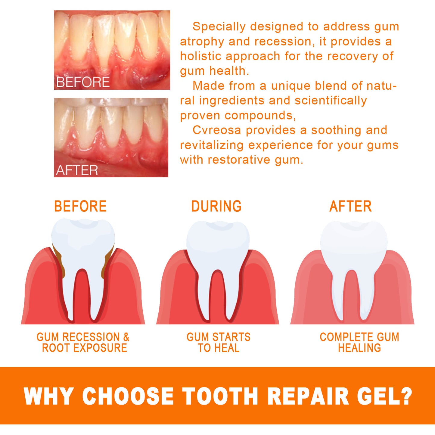Gum Repair Ampoules