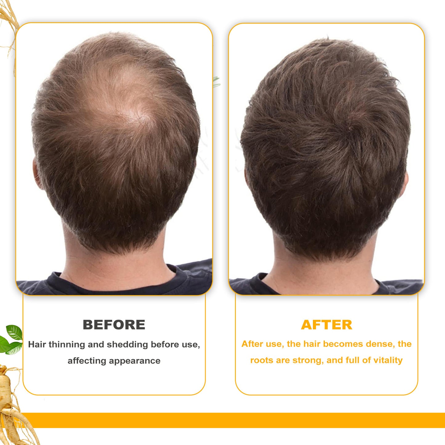 Biotin Hair Growth