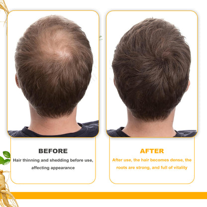Biotin Hair Growth