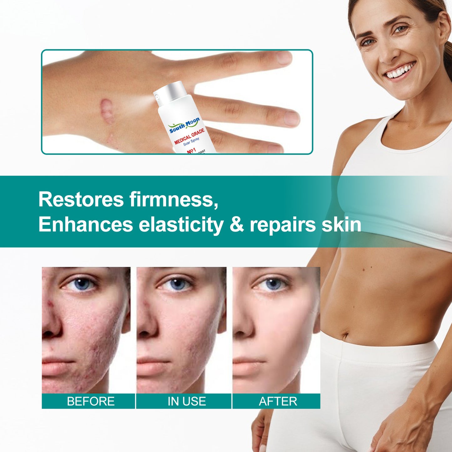 Advanced Acne Scar Spray