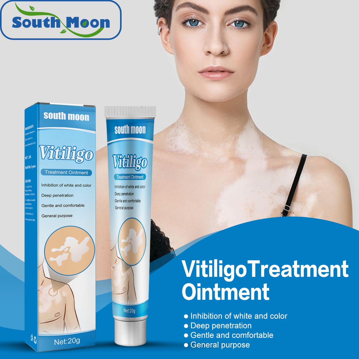South Moon Vitiligo Treatment