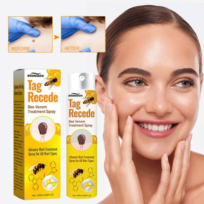 Wart Treatment Spray