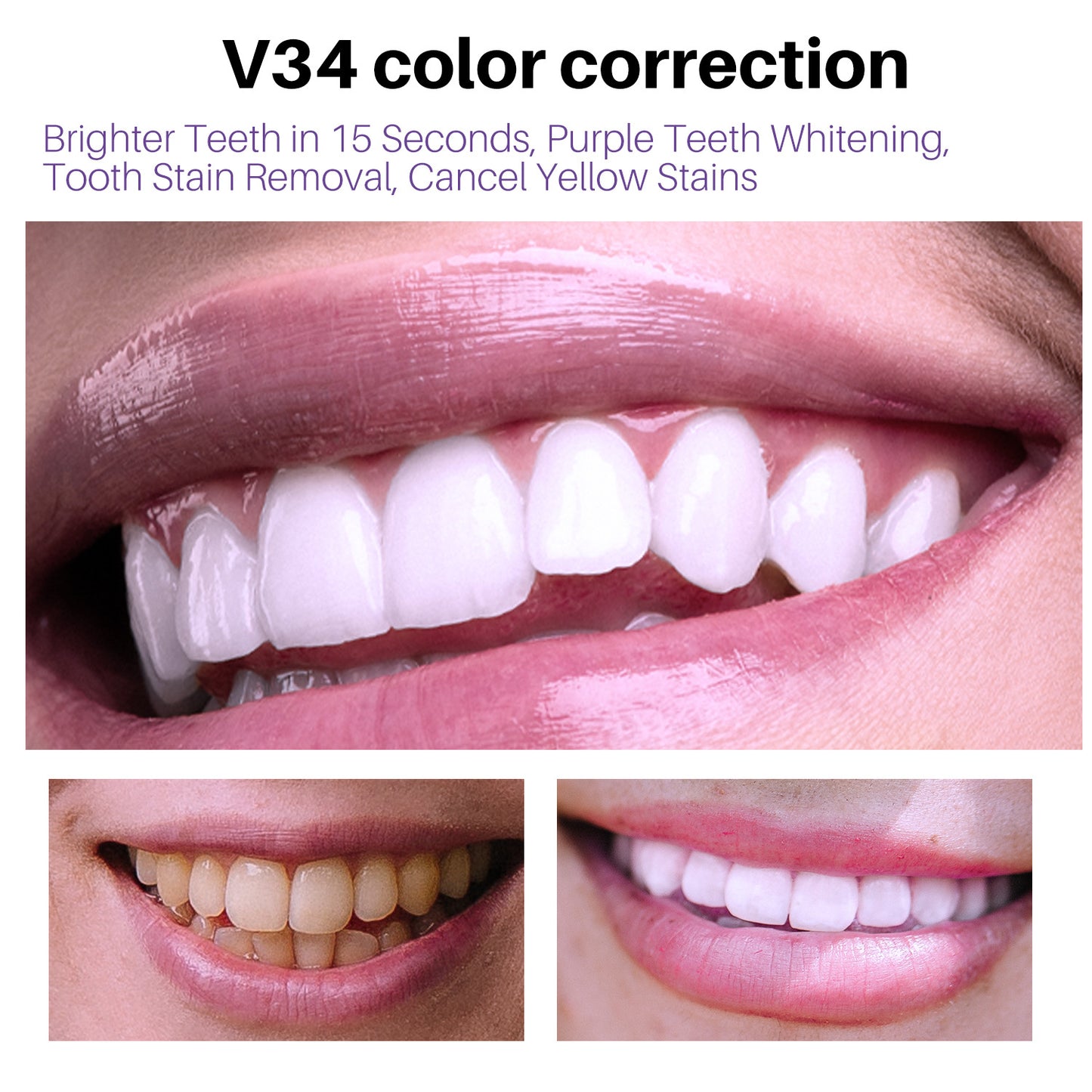 Teeth V34 Whitening Mousse Gel