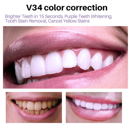 Teeth V34 Whitening Mousse Gel