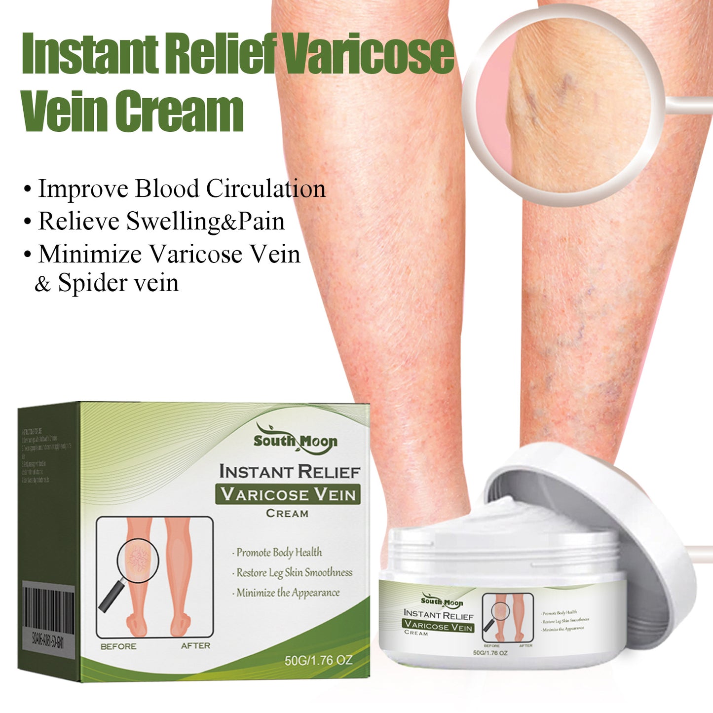 Varicose Vein Cream