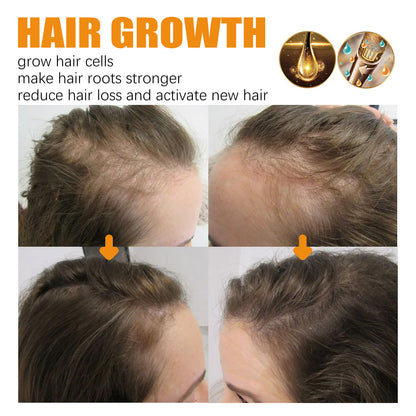 Biotin Hair Growth