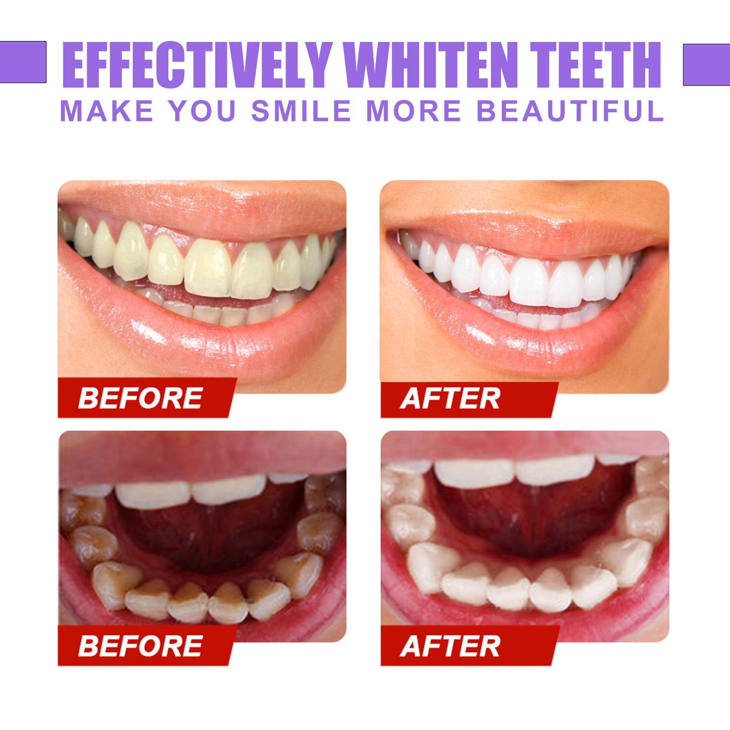 Tanden Whitening V34 Serum