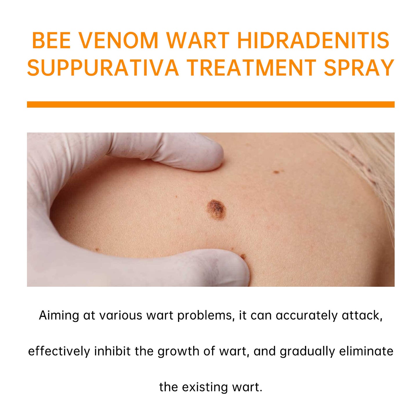Wart Treatment Spray