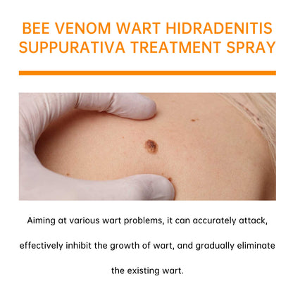 Wart Treatment Spray