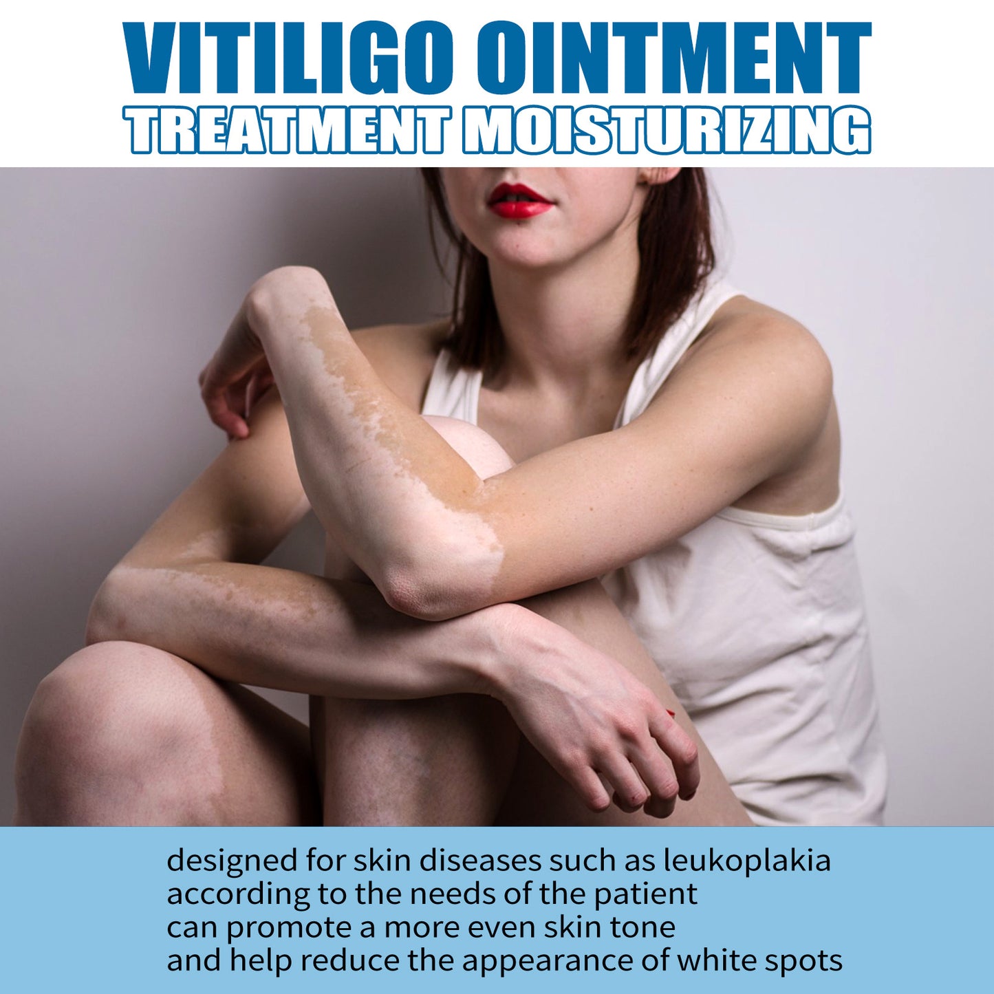 South Moon Vitiligo Treatment