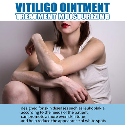 South Moon Vitiligo Treatment