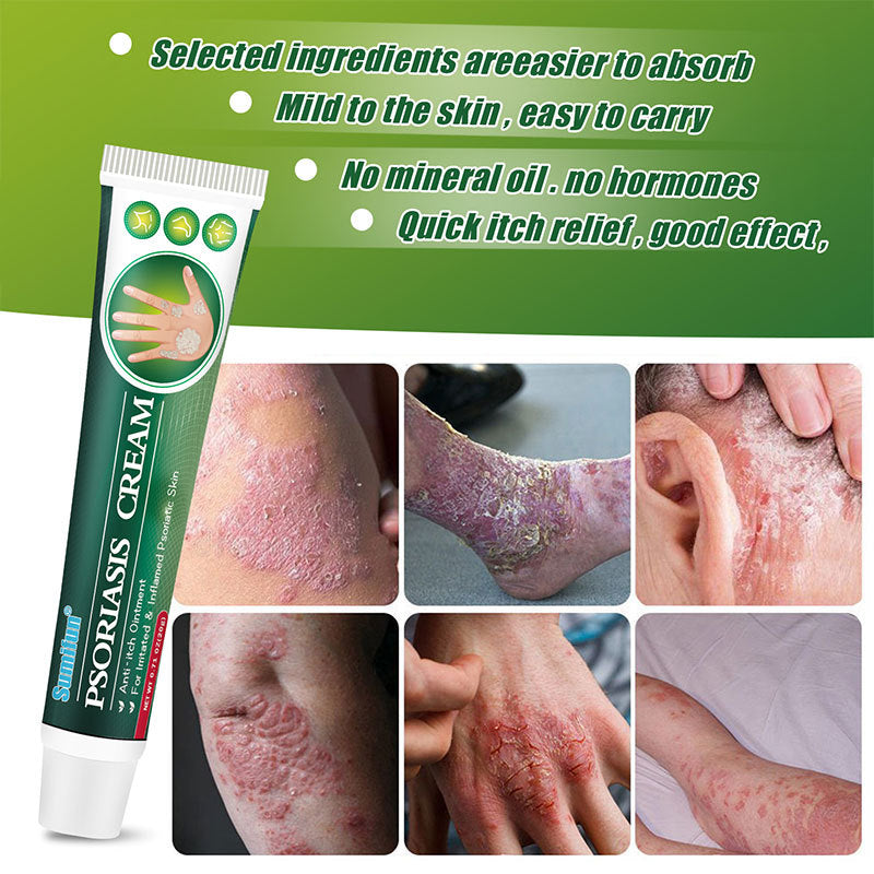 Psoriasis Cream Care