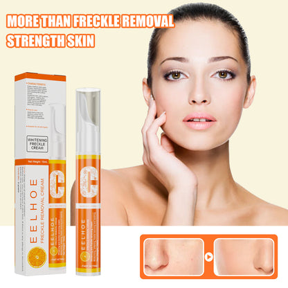 EELHOE Freckle Removal Cream