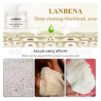 Blackhead Removal Nose Mask