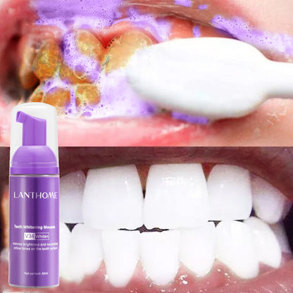 Teeth V34 Whitening Mousse Gel