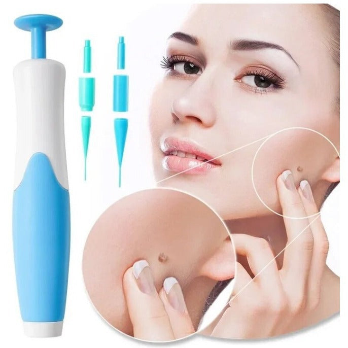 Auto Skin Tag Remover Kit