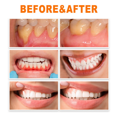 Gum Repair Ampoules