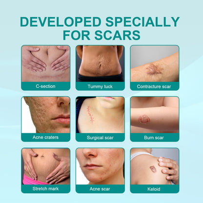 Advanced Acne Scar Spray
