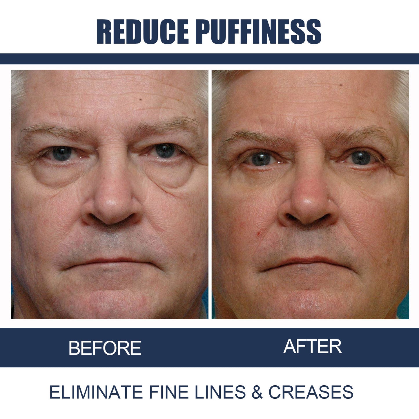 Peptide Firming Eye Gel
