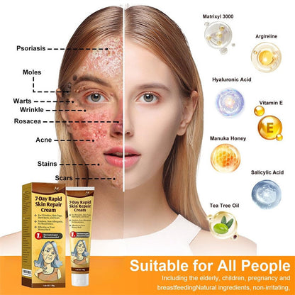 Acne Scar Repair Cream