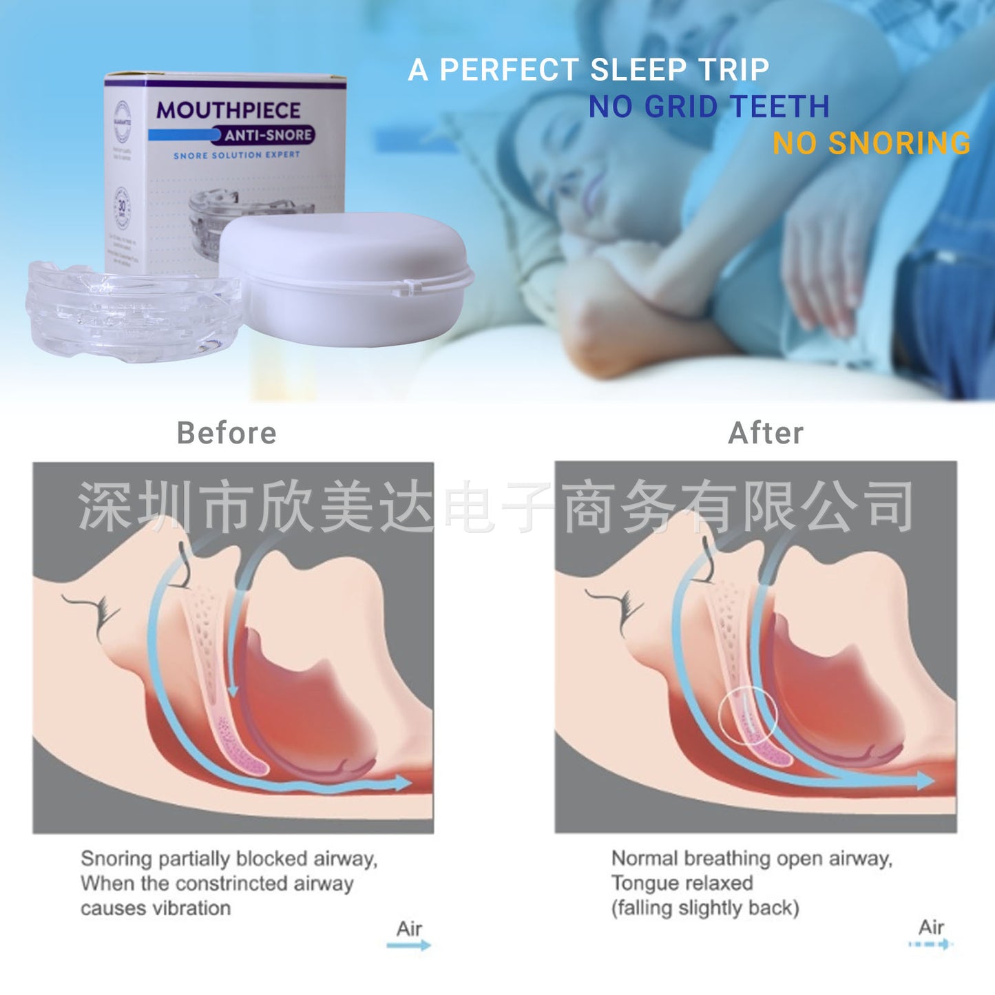 Anti-Snore Mouthpiece
