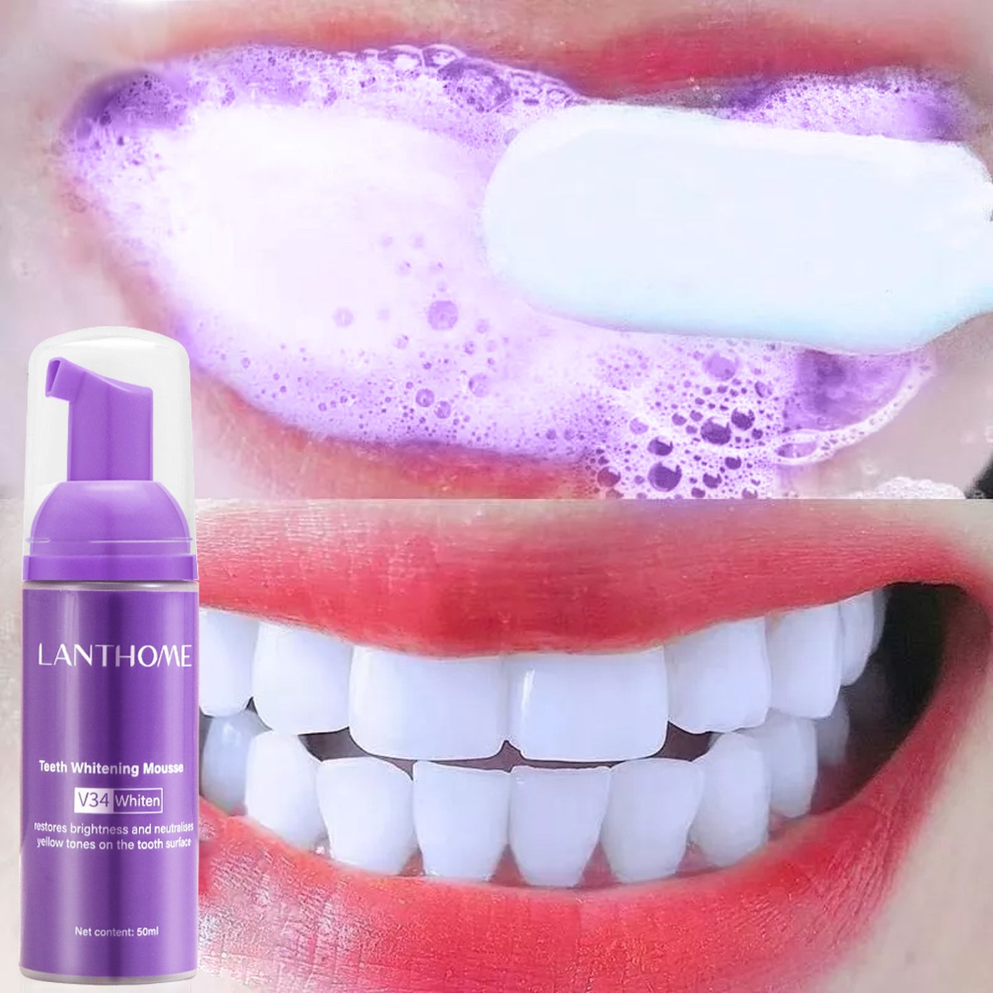 Teeth V34 Whitening Mousse Gel
