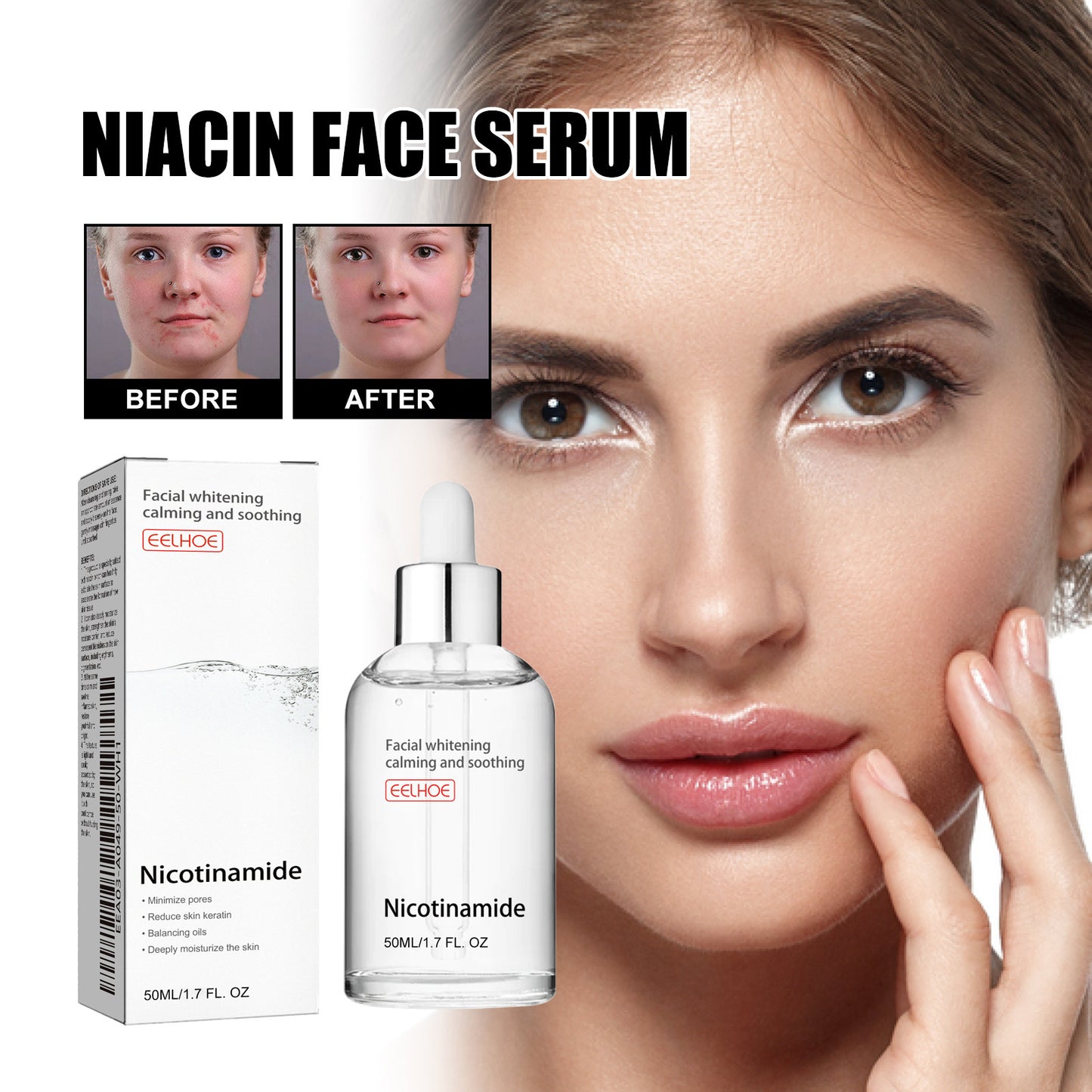 Acne Whitening Serum