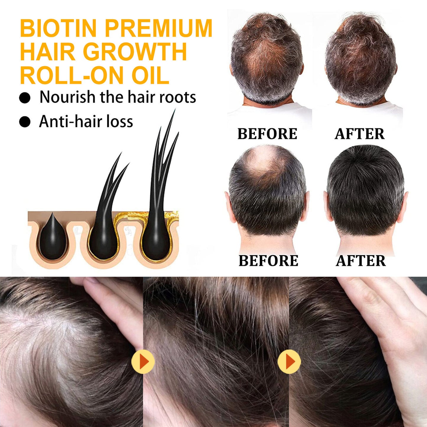 Biotin Hair Growth