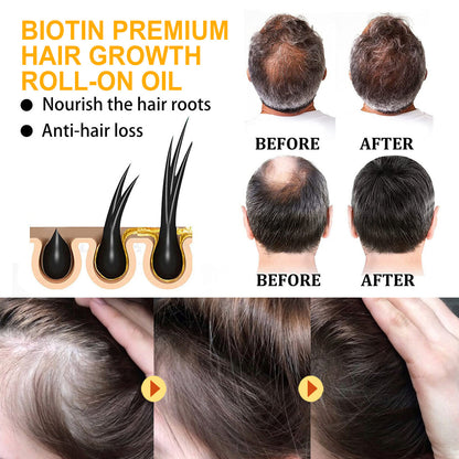 Biotin Hair Growth